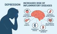 افسردگی می تواند با افزایش خطر ابتلا به بیماری‌های التهابی مرتبط باشد